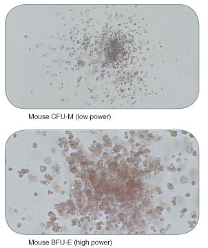 Examples of Colonies Derived from Mouse Hematopoietic Progenitors