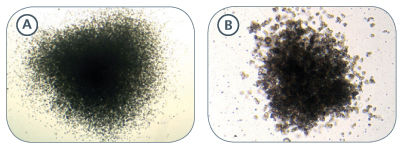 Examples of Colonies Derived From Mouse Hematopoietic Progenitors