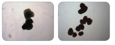 Examples of Colonies Derived from BFU-E in MethoCult™ H4034 Optimum