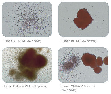 Examples of Colonies Derived from Human Hematopoietic Progenitors