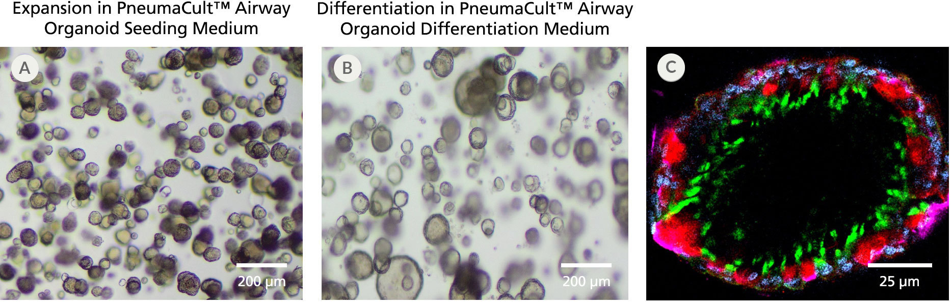 Fully differentiated human airway organoids generated using PneumaCult™ Airway Organoid Kit display physiologically relevant morphology.