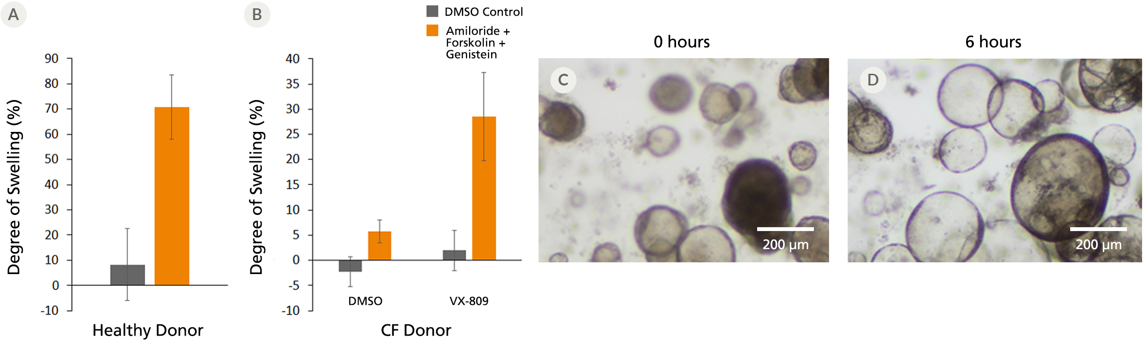 Comparison of Forskolin-treated airway organoids derived from healthy donors and CF donors.