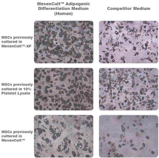 Adipogenic Differentiation of Human Bone Marrow-Derived MSCs