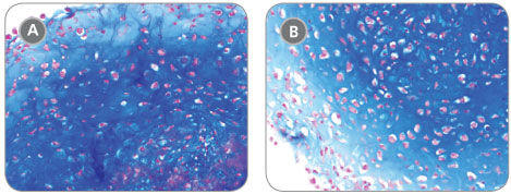 MesenCult™-ACF Chondrogenic Differentiation Medium Induces Robust Chondrogenic Differentiation of Human MSCs