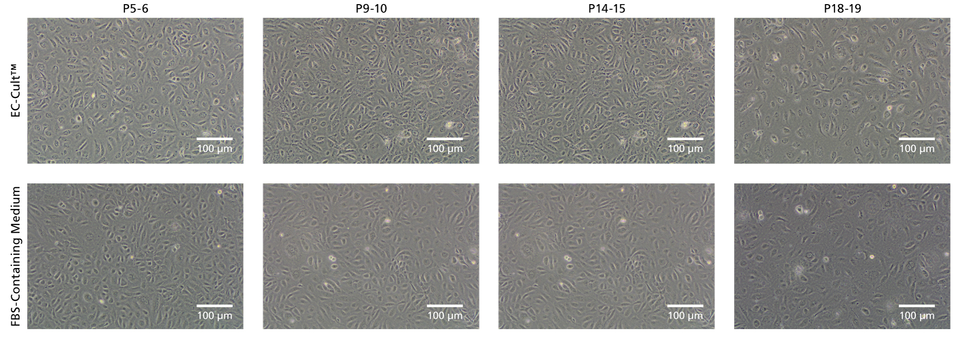 EC-Cult™ Medium Enables Long-Term Expansion of HUVECs in an FBS-Free Setting