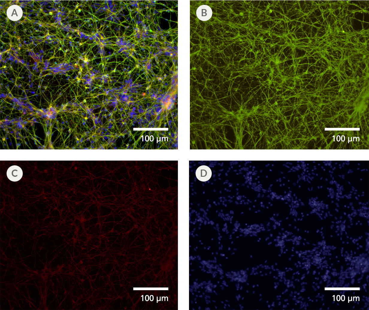 Forebrain-Type Neurons Are Generated from Neural Progenitor Cells After Culture in STEMdiff™ SMADi Neural Induction Kit and STEMdiff™ Forebrain Neuron Differentiation and Maturation Kits