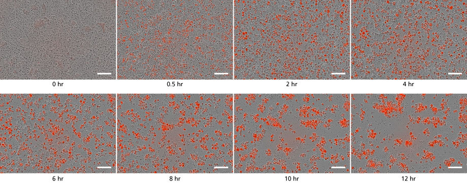 Time lapse of functional microglia phagocytosing bioindicator particles in culture. Over time, cells turn red and aggregate.