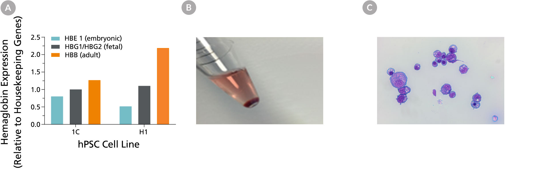 Figures showing erythroid cells generated using STEMdiff™ Erythroid Kit are hemoglobinized and display typical morphology