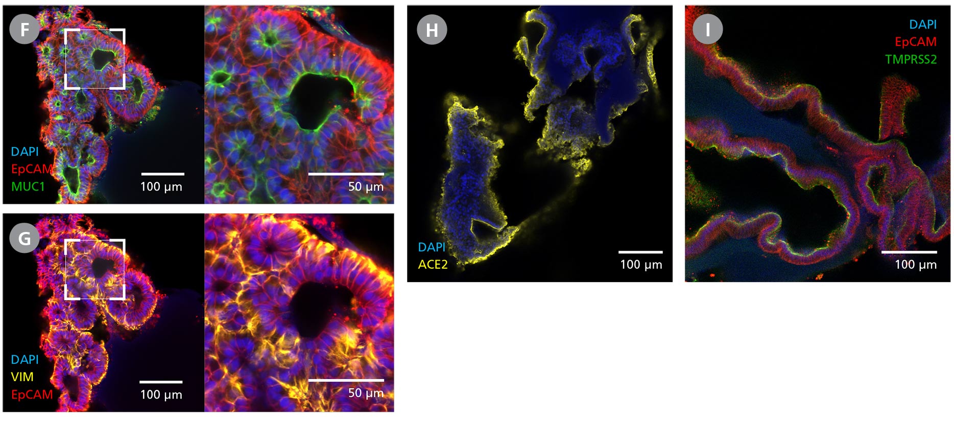 Panel of immunocytochemistry (ICC) images demonstrating the protein expression of key lung markers in branching lung organoids generated using STEMdiff™ Branching Lung Organoid Kit and matured using STEMdiff™ Branching Lung Organoid Maturation Kit.